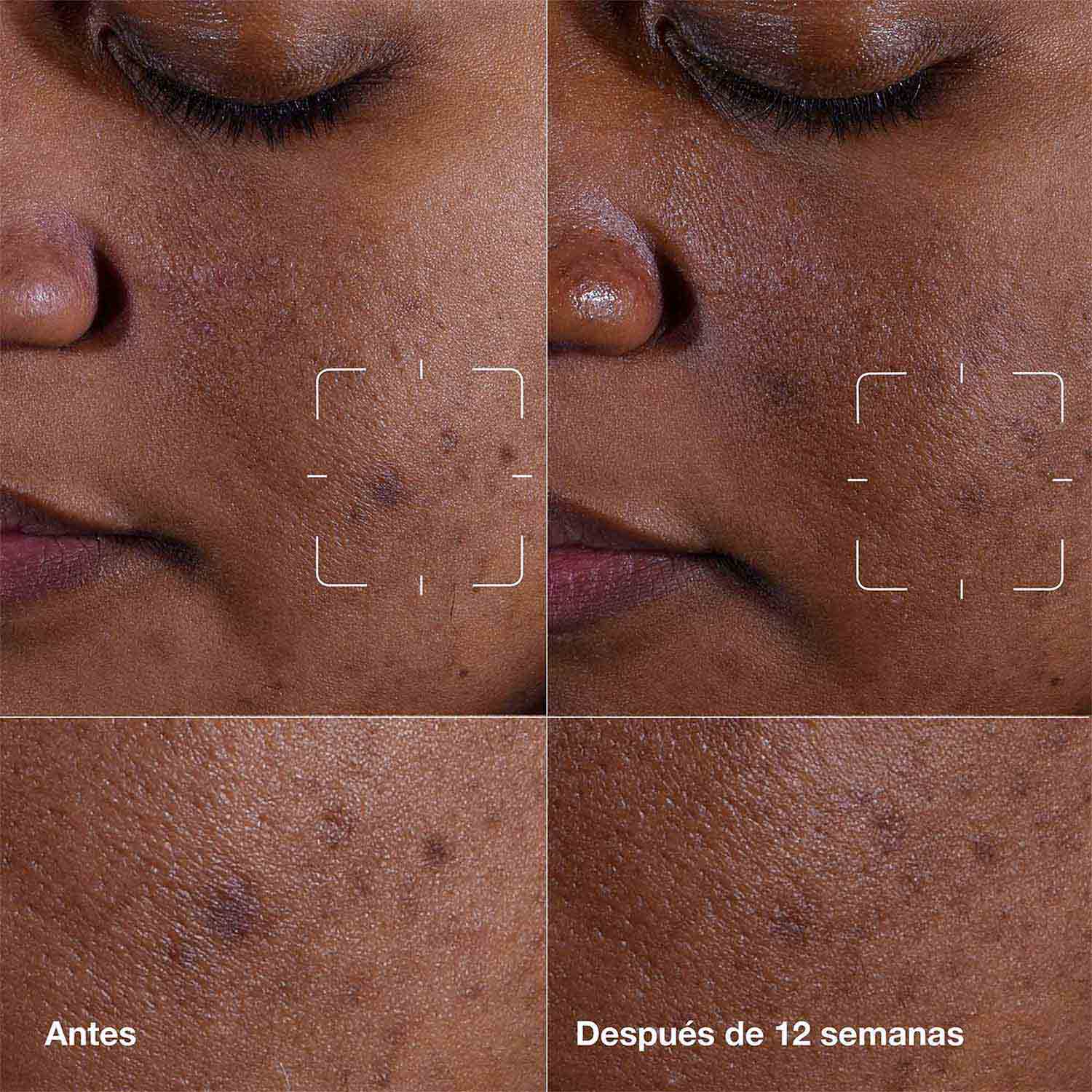 EVEN BETTER CLINICAL DARK SPOT CLEARING SERUM