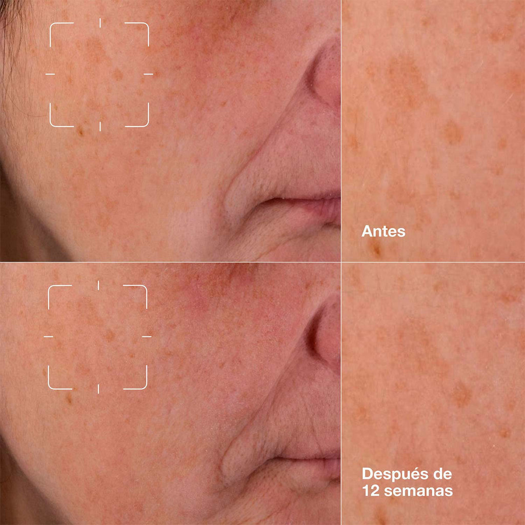 EVEN BETTER CLINICAL DARK SPOT CLEARING SERUM