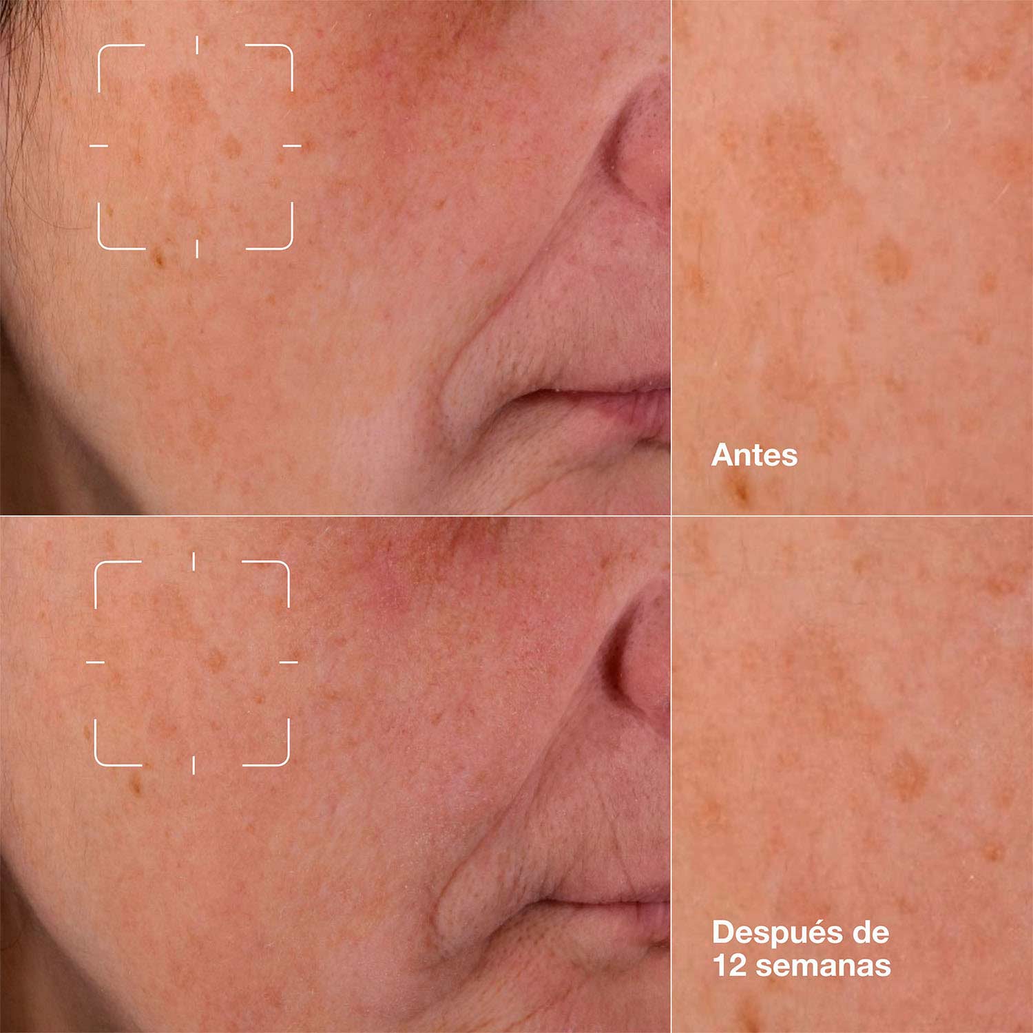 EVEN BETTER CLINICAL DARK SPOT CLEARING SERUM