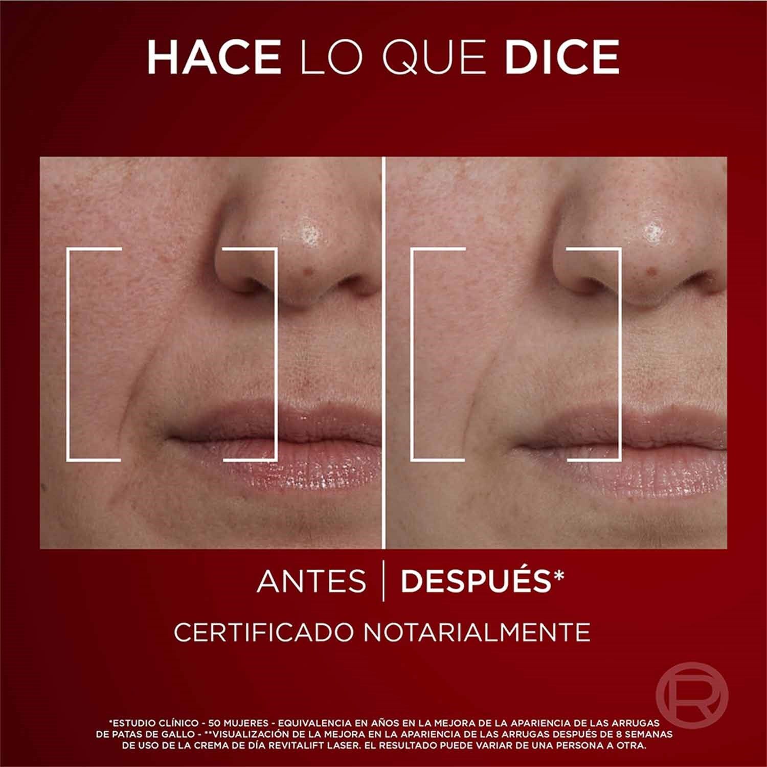 REVITALIFT LASER CREMA DÍA